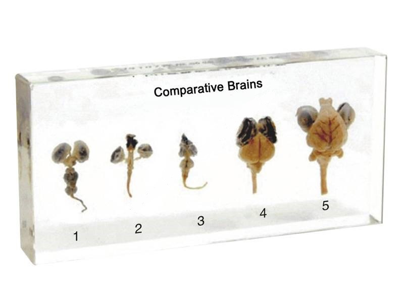 Мозок 5-ти типів