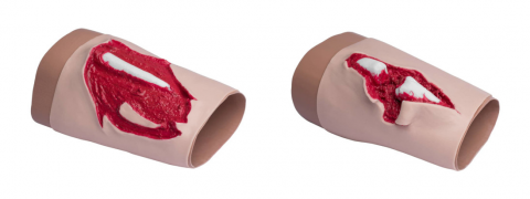 Комплект муляжів з відкритим переломом кінцівки та ушкодженням кістки